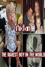 Watch Aidan The Rarest Boy In The World Megashare9