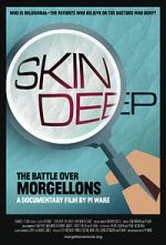 Watch Skin Deep: The Battle Over Morgellons Megashare9