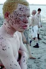 Watch Albino United Megashare9