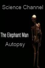 Watch Science Channel Elephant Man Autopsy Megashare9