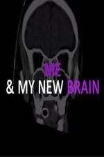 Watch Me & My New Brain Megashare9