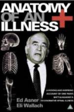 Watch Anatomy of an Illness Megashare9