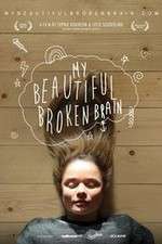 Watch My Beautiful Broken Brain Megashare9