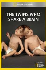 Watch National Geographic The Twins Who Share A Brain Megashare9