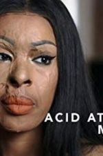 Watch Acid Attack: My Story Megashare9