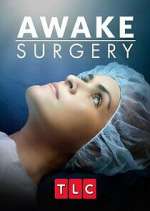 Watch Awake Surgery Megashare9