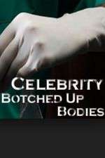 Watch Celebrity Botched Up Bodies Megashare9